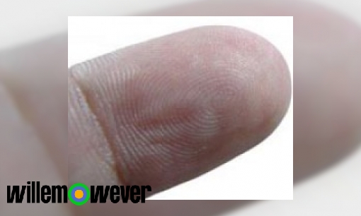 Als je vel van je vinger is geweest heb je dan gewoon weer je oude vingerafdruk?