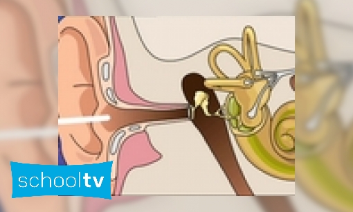 Plaatje Gehoorbeschadiging
