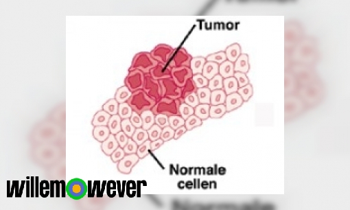 Plaatje Hoe kan het dat je haren uitvallen van de medicijnen tegen tumoren?