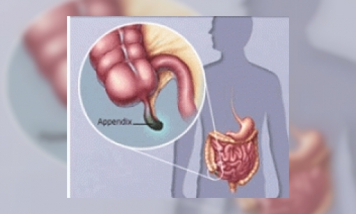 Plaatje Hoe kan iemand een blindedarmontsteking krijgen?