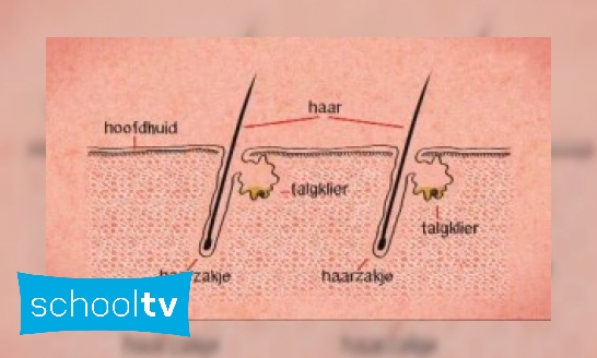 Plaatje Wat is acne?