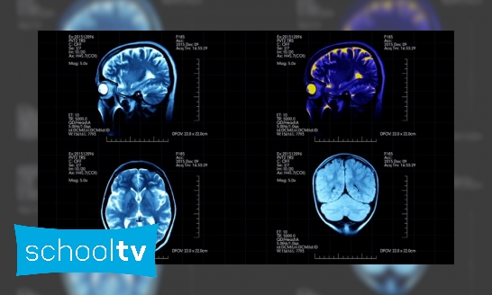 Plaatje Wat is neuromarketing?