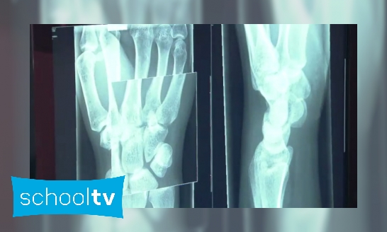 Plaatje Hoe werkt een röntgenapparaat?